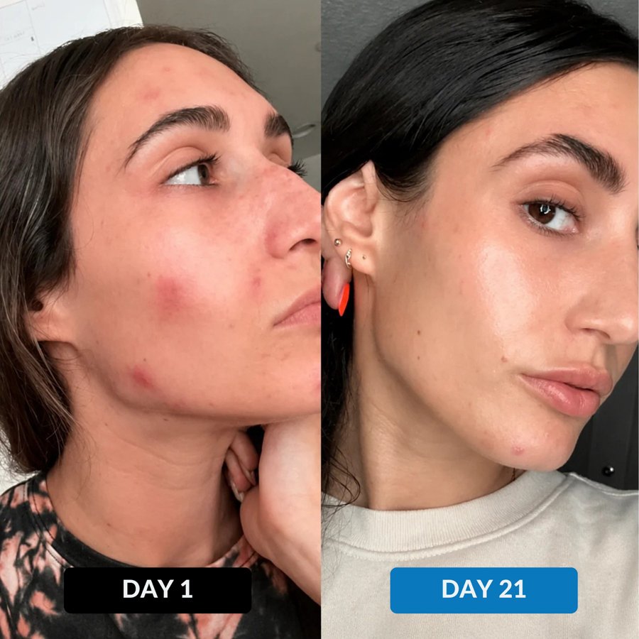 Skin — day 1 vs day 21