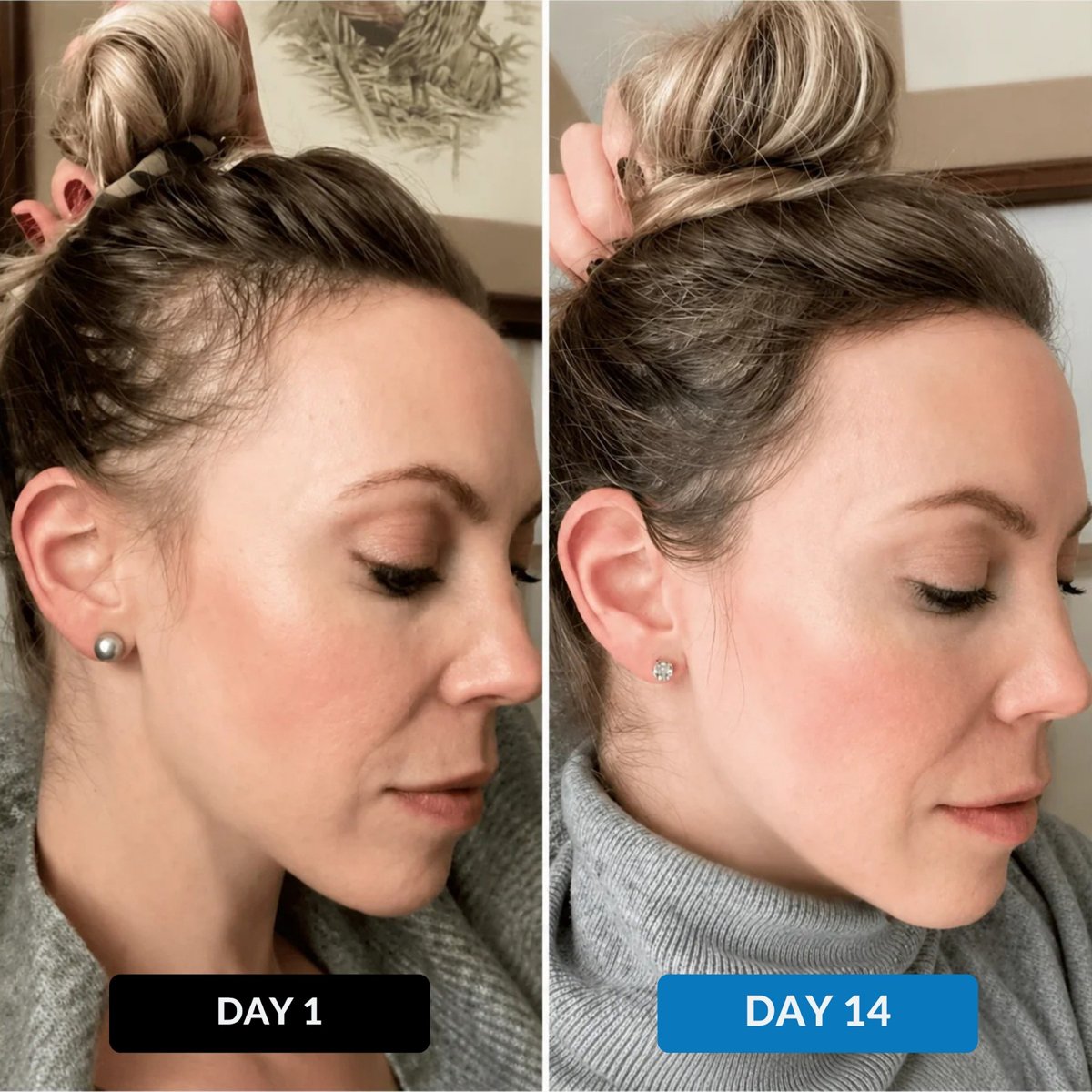 Day 1 vs Day 14 with the haya. filtered shower head